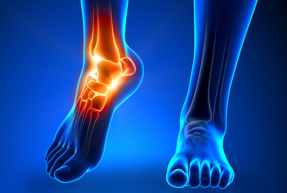 Ankle and Foot Pain / Injuries