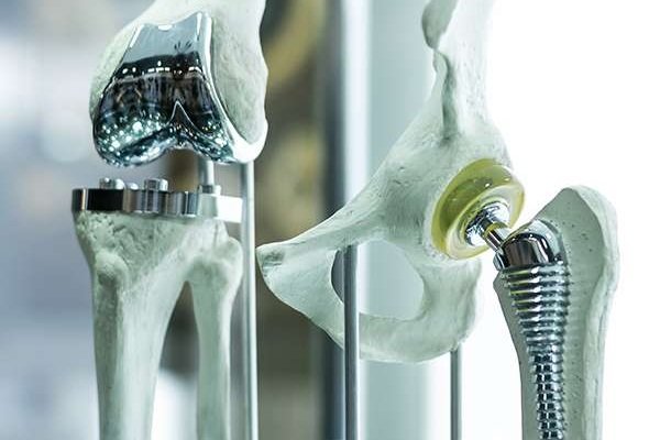 Joint Replacement (Knee, Hip, Shoulder & Elbow)