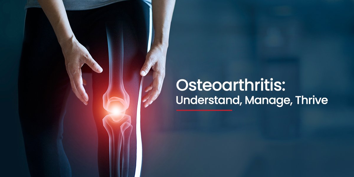 Osteo Arthritis Treatment