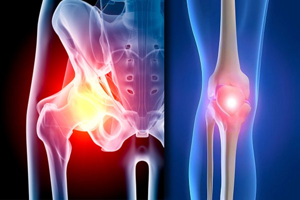 Polytrauma & All Fracture Cases